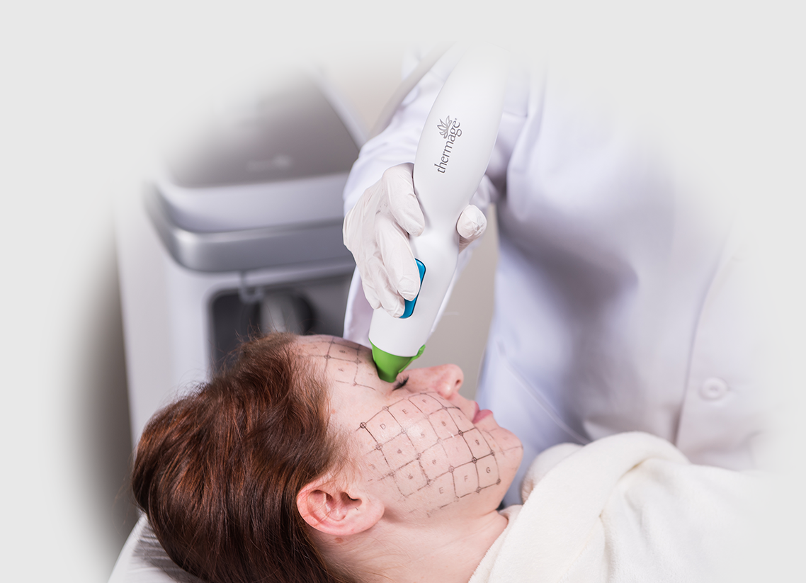 Solta treatment